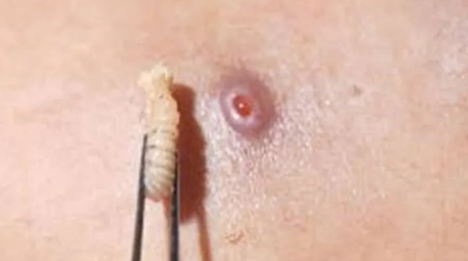 Miasis por gusano&nbsp;barrenador